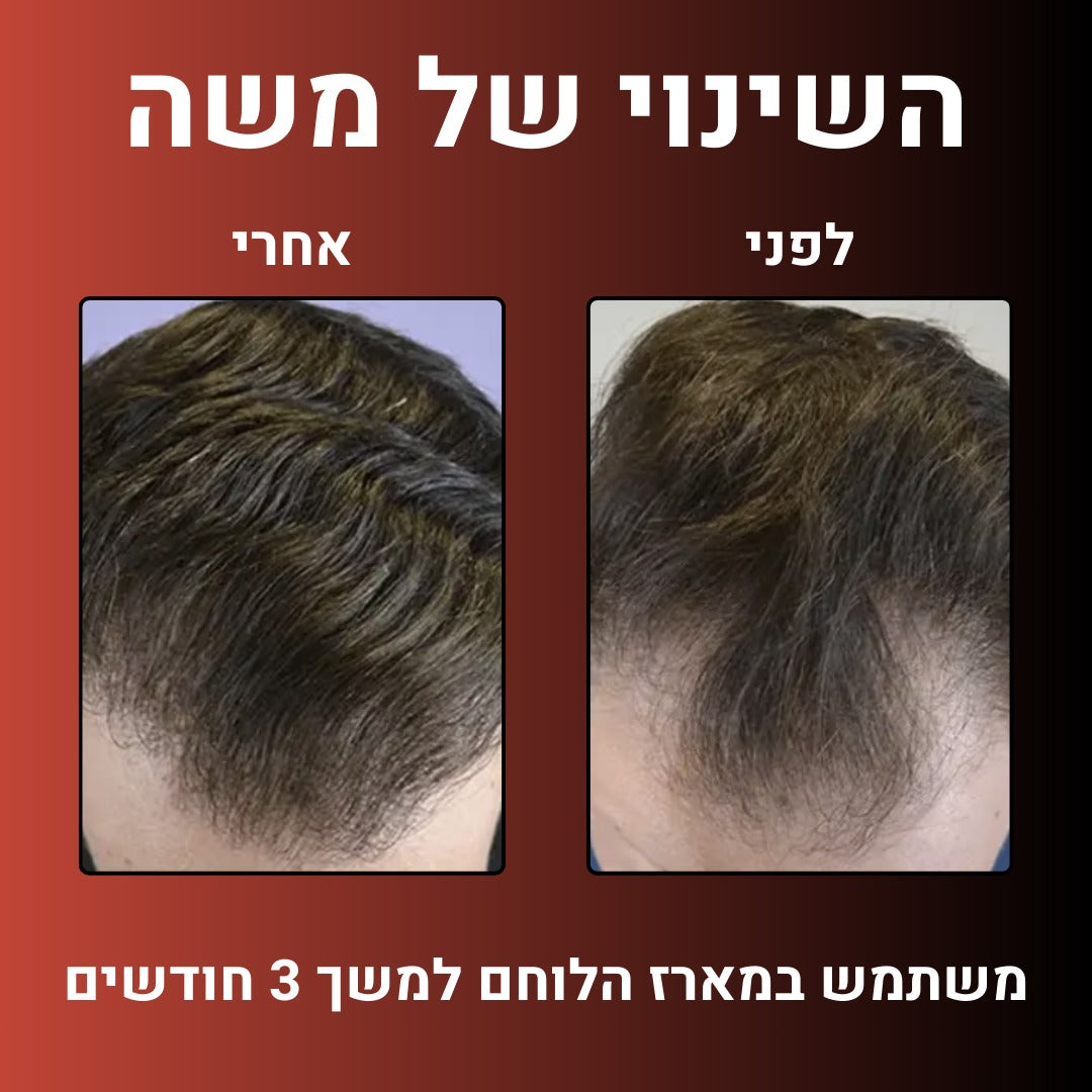 מארז הלוחם™- הצעה אחרונה ב- 50%