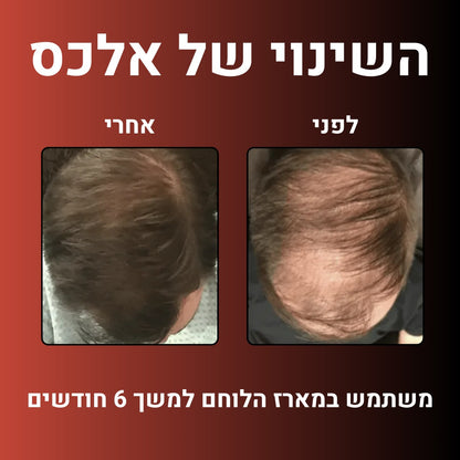מארז הלוחם™- הצעה אחרונה ב- 50%