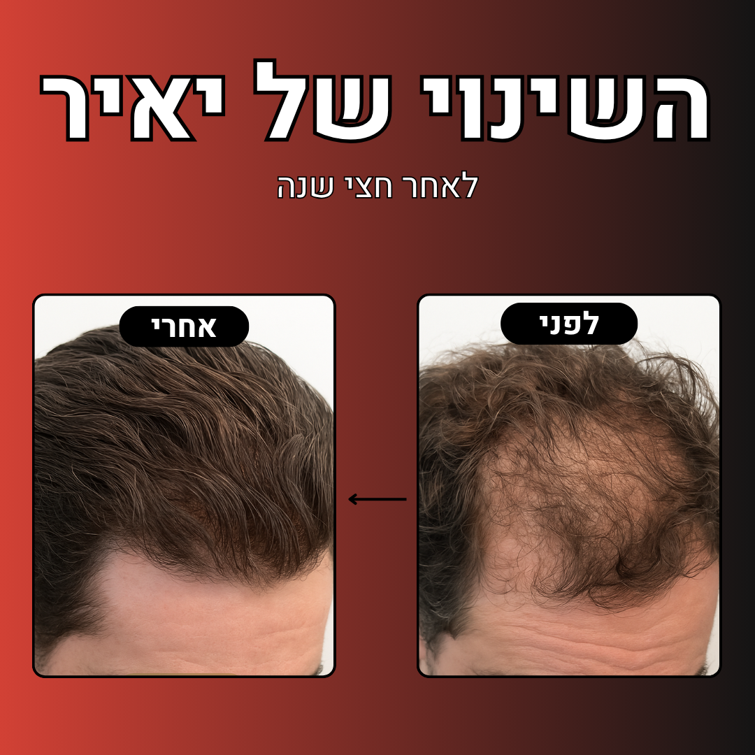 מארז הלוחם™- מארז נוסף ב- 30%