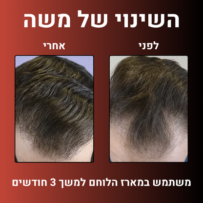 מארז הלוחם™- ערכה לטיפול ושיקום נשירת שיער הגבר