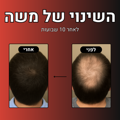 מארז הלוחם™- מארז נוסף ב- 30%