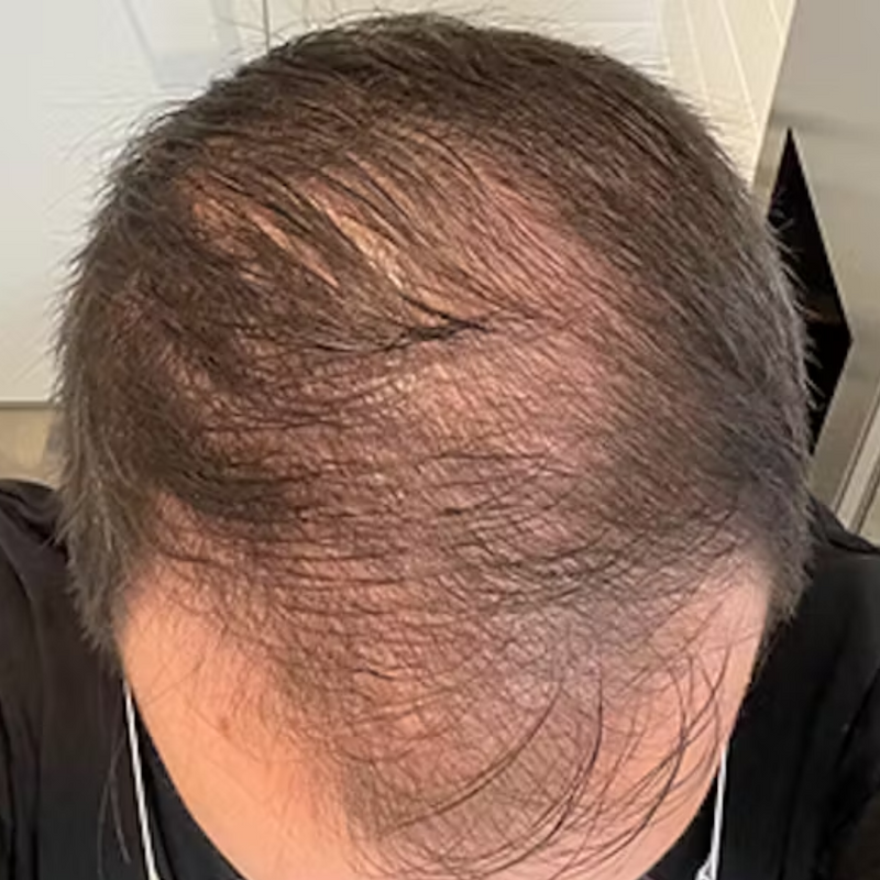 לפני - שמעון מ. ⭐️⭐️⭐️⭐️⭐️