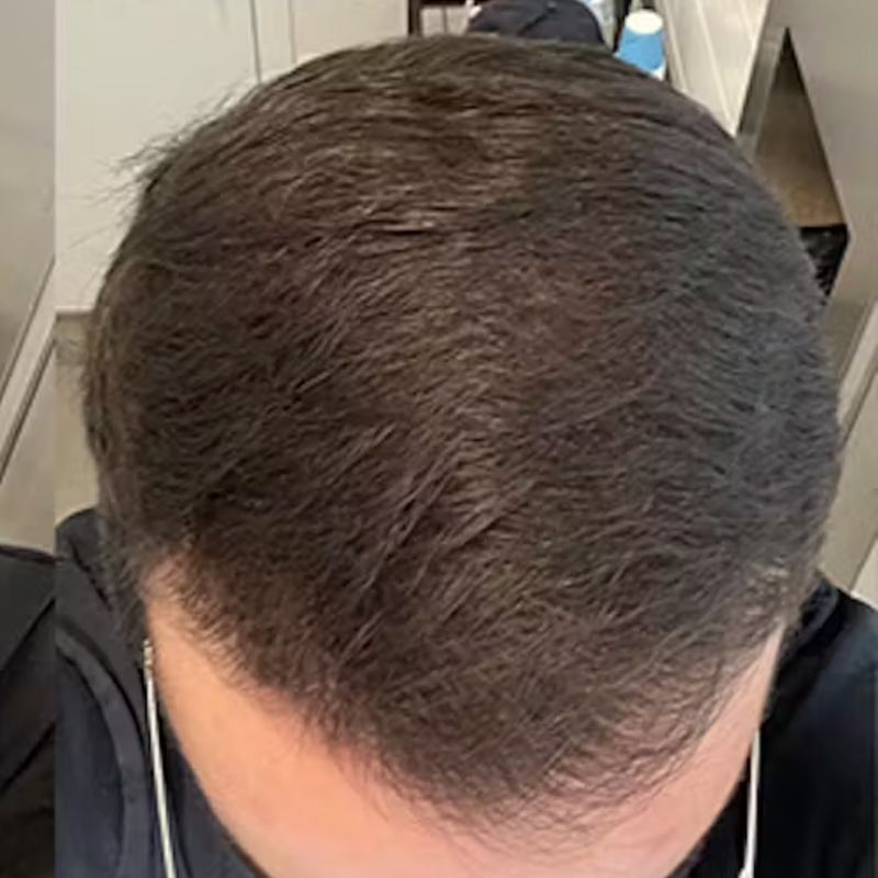 אחרי - שמעון מ. ⭐️⭐️⭐️⭐️⭐️