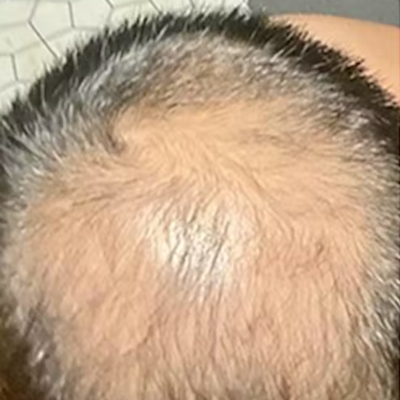 לפני - עידן ח.⭐⭐⭐⭐⭐