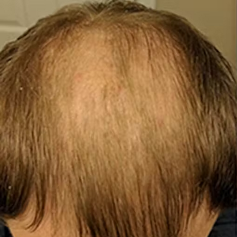 לפני - רועי ד. ⭐⭐⭐⭐⭐