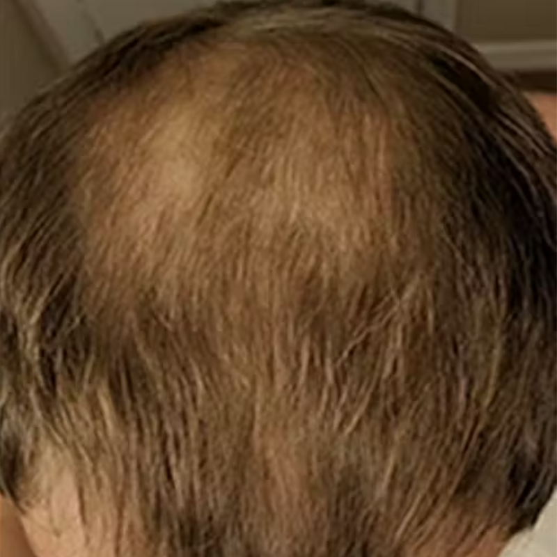 אחרי - רועי ד. ⭐⭐⭐⭐⭐