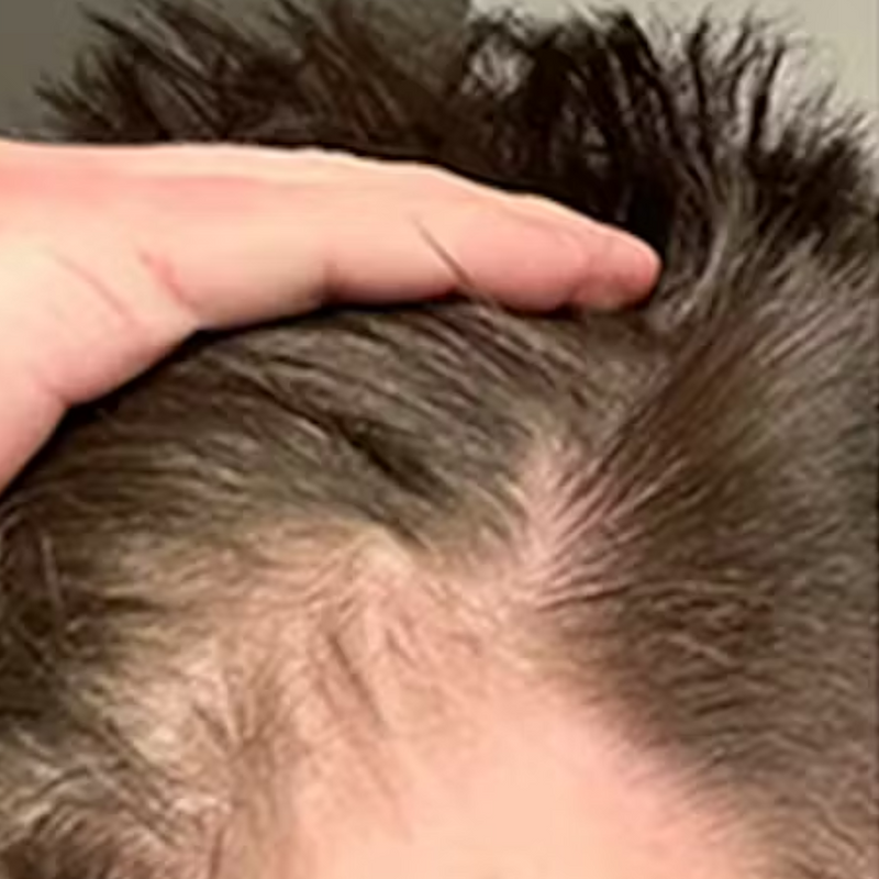 לפני - תומר ש. ⭐⭐⭐⭐⭐