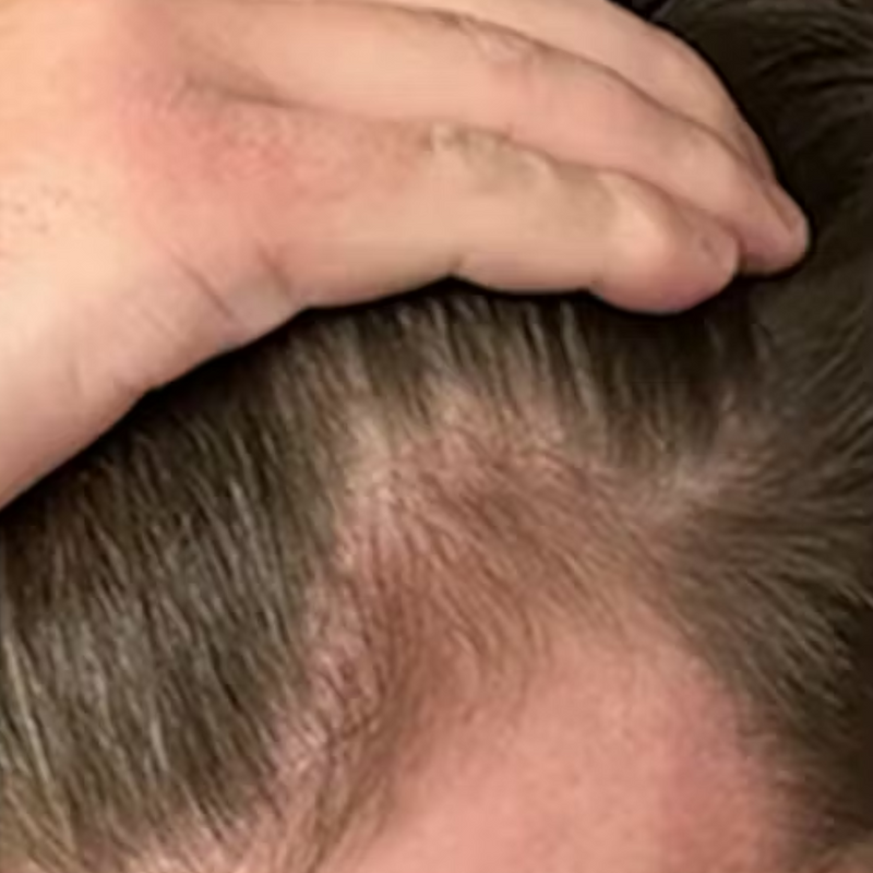 אחרי - תומר ש. ⭐⭐⭐⭐⭐