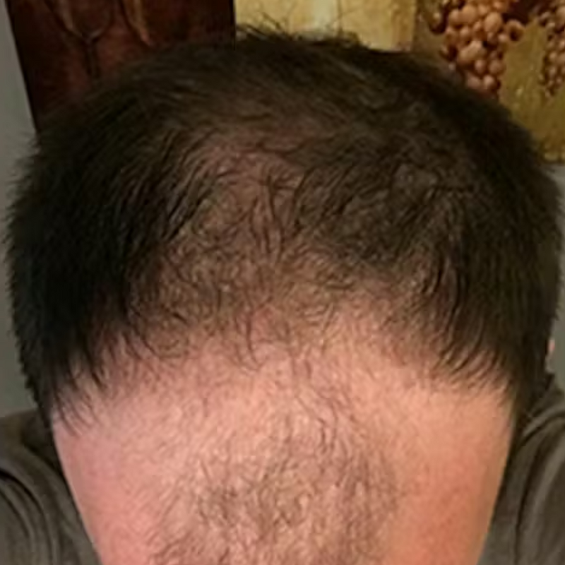 לפני - שלומי ע.⭐⭐⭐⭐⭐