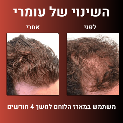 מארז הלוחם™- ערכה לטיפול ושיקום נשירת שיער הגבר