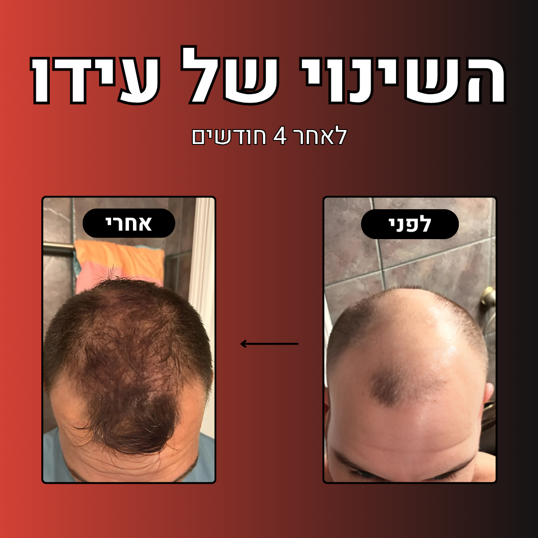 מארז הלוחם™- מארז נוסף ב- 30%