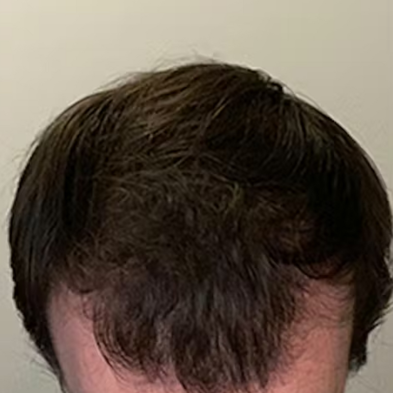 אחרי - שלומי ע.⭐⭐⭐⭐⭐