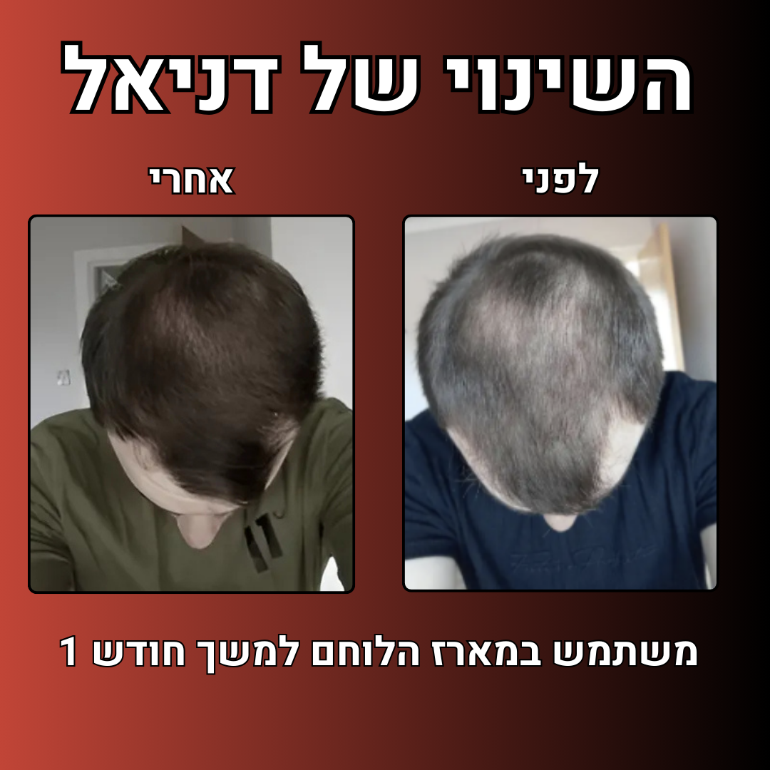 מארז הלוחם™- ערכה לטיפול ושיקום נשירת שיער הגבר
