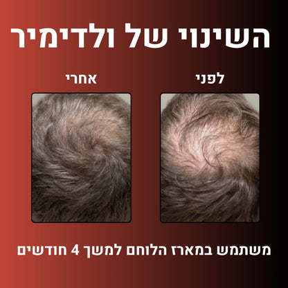 מארז הלוחם™- הצעה אחרונה ב- 50%