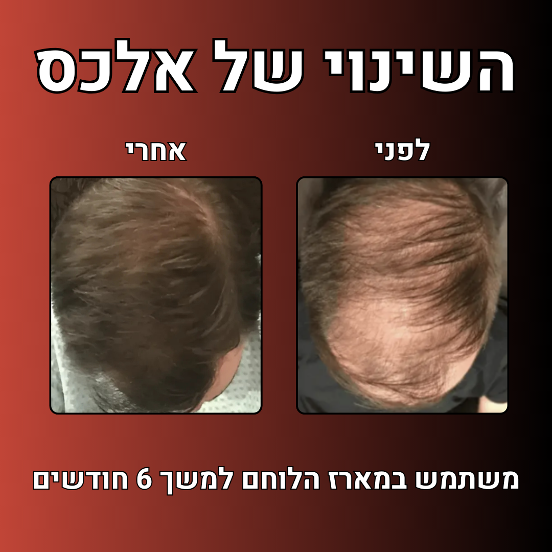 מארז הלוחם™- ערכה לטיפול ושיקום נשירת שיער הגבר