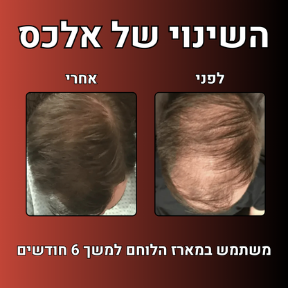 מארז הלוחם™- ערכה לטיפול ושיקום נשירת שיער הגבר