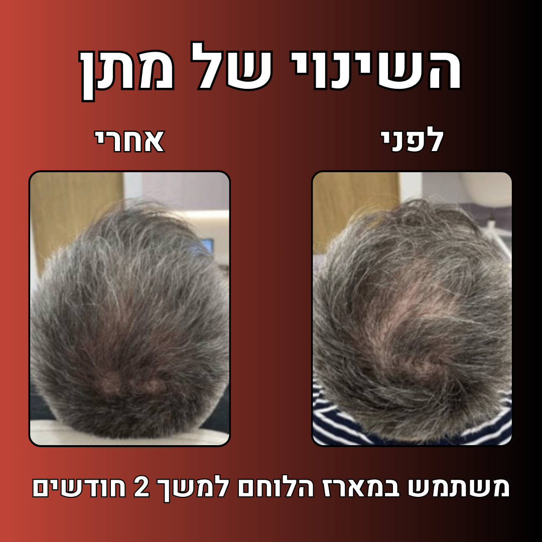 מארז הלוחם™- ערכה לטיפול ושיקום נשירת שיער הגבר