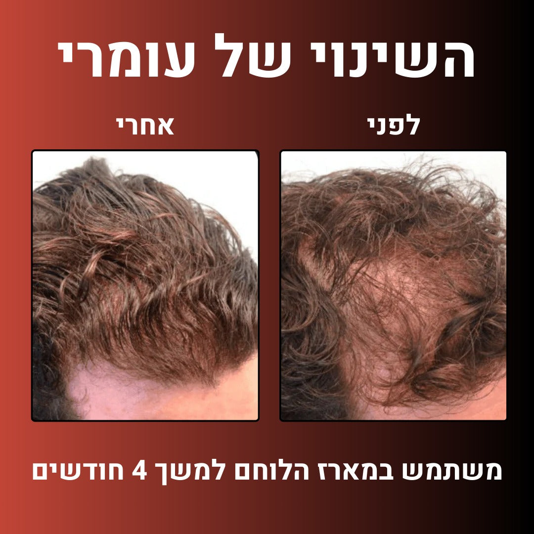 מארז הלוחם™- הצעה אחרונה ב- 50%